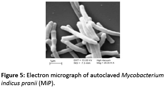 reproductive-immunology-Electron-micrograph-autoclaved