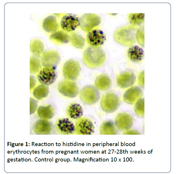 reproductive-immunology-Reaction-histidine